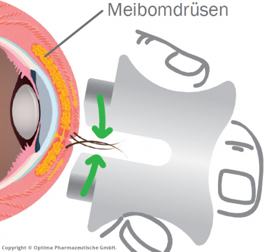 Lipo Nit Eyepeace Lid-Massagehilfe